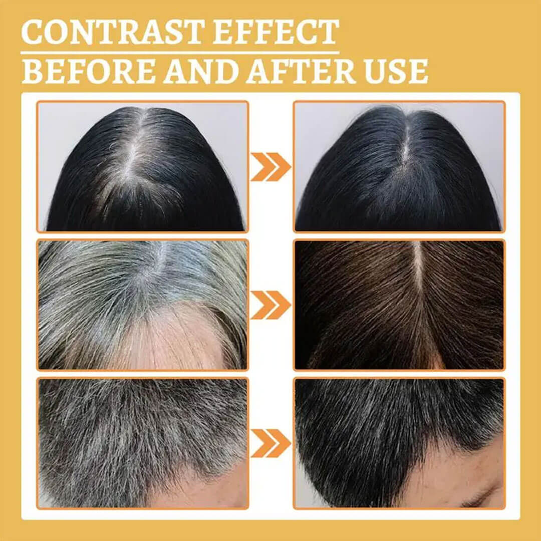 Treatment Serum Liquid White To Black