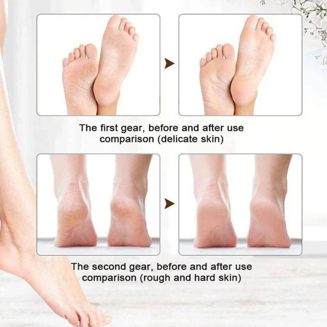USB Foot Grinding Machine